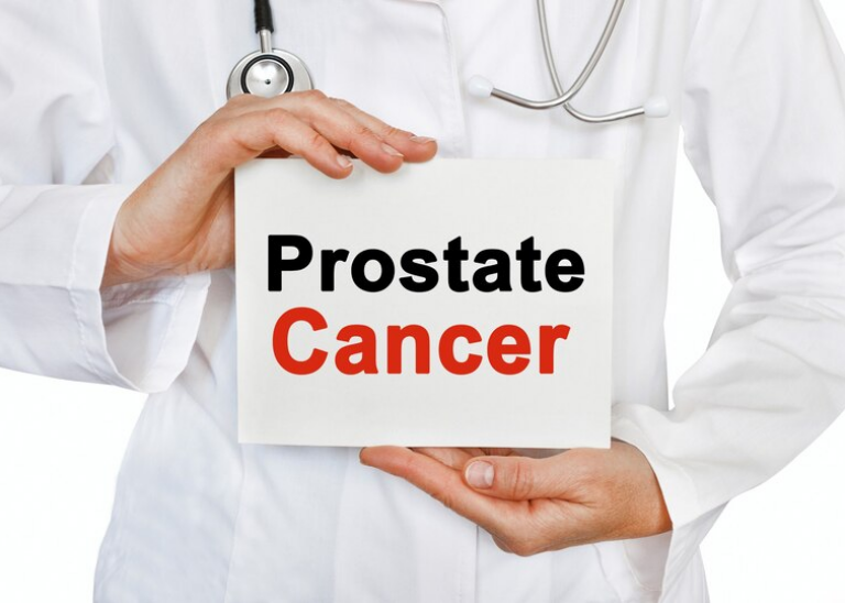 kanker-prostat-dan-kemandulan