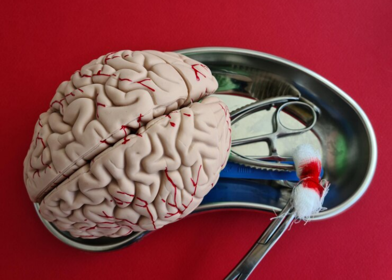 tumor-otak