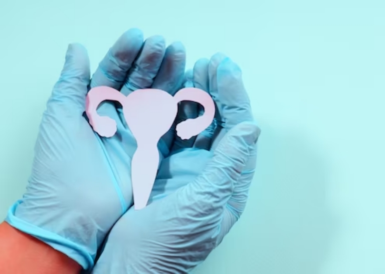 gambar rahim - perbedaan kanker serviks dan polip rahim