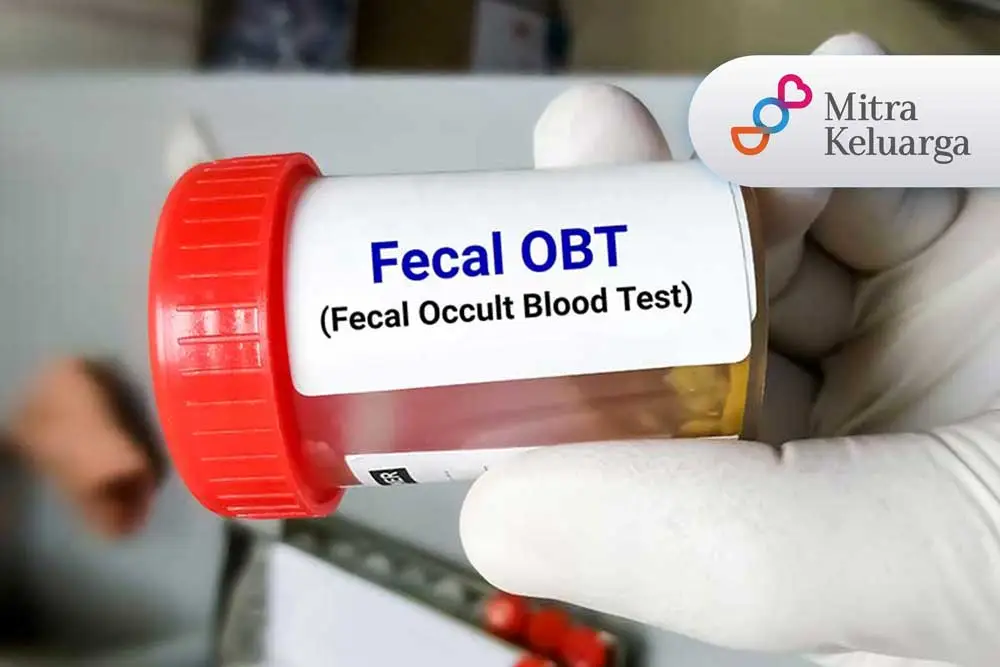FOBT (Fecal Occult Blood Test) Feses Rutin